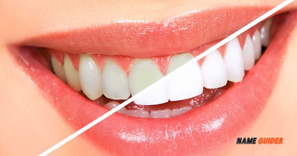 Teeth whitening business name ideas